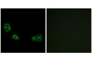 Immunofluorescence analysis of MCF-7 cells, using TMEM185A antibody. (TMEM185A antibody  (C-Term))