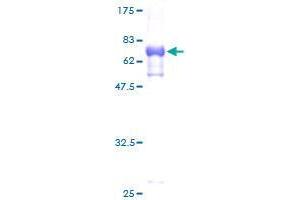 TES Protein (AA 1-421) (GST tag)