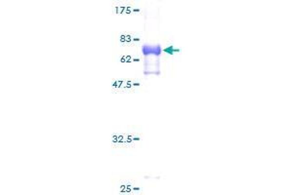 TES Protein (AA 1-421) (GST tag)