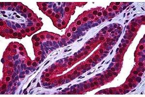 Human Prostate: Formalin-Fixed, Paraffin-Embedded (FFPE)