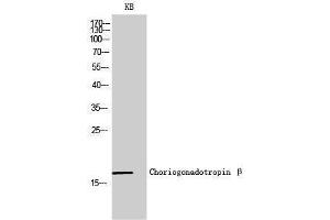 Western Blotting (WB) image for anti-Chorionic Gonadotropin, beta Polypeptide (CGB) (C-Term) antibody (ABIN3183911) (CGB antibody  (C-Term))
