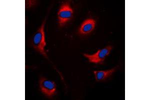 Immunofluorescent analysis of SOCS1 staining in MCF7 cells. (SOCS1 antibody  (Center))