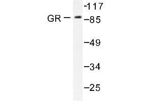 Image no. 1 for anti-Nuclear Receptor Subfamily 3, Group C, Member 1 (Glucocorticoid Receptor) (NR3C1) antibody (ABIN271889) (Glucocorticoid Receptor antibody)