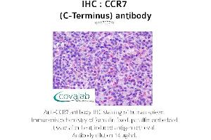 Image no. 1 for anti-Chemokine (C-C Motif) Receptor 7 (CCR7) (C-Term) antibody (ABIN1732781) (CCR7 antibody  (C-Term))