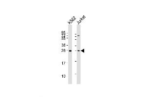 Western Blot at 1:2000 dilution Lane 1: K562 whole cell lysates Lane 2: Jurkat whole cell lysates Lysates/proteins at 20 ug per lane. (BASP1 antibody  (AA 123-150))