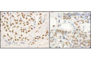 Immunohistochemistry (IHC) image for anti-Fused in Sarcoma (FUS) (C-Term) antibody (ABIN7453401)