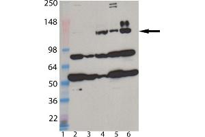 Western blot analysis of MDA5 monoclonal antibody (1B6) : Lane 1: MW marker, Lane 2: HeLa, Lane 3: A431, Lane 4: L929, Lane 5: 3T3, Lane 6: Jurkat cell lysate. (IFIH1 antibody  (AA 78-555))
