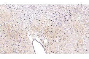 Detection of APC in Rat Cerebrum Tissue using Polyclonal Antibody to Adenomatosis Polyposis Coli Protein (APC) (APC antibody  (AA 2634-2842))