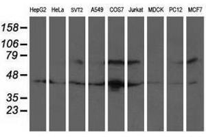 Image no. 3 for anti-General Transcription Factor IIF, Polypeptide 1, 74kDa (GTF2F1) antibody (ABIN1500596) (GTF2F1 antibody)