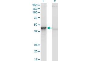 Western Blot analysis of ACY1 expression in transfected 293T cell line by ACY1 monoclonal antibody (M01), clone 4F1-B7.