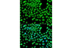 Immunofluorescence analysis of A549 cells using GOPC antibody (ABIN5975587). (GOPC antibody)