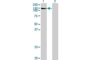 Thyroperoxidase antibody  (AA 672-779)