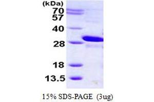 SDS-PAGE (SDS) image for Muscle RAS Oncogene Homolog (MRAS) (AA 1-205) protein (His tag) (ABIN667993)
