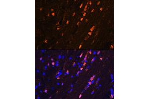 Immunofluorescence analysis of mouse brain using S100B Rabbit mAb (ABIN7270131) at dilution of 1:100 (40x lens). (S100B antibody)