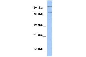 LCMT2 antibody used at 1 ug/ml to detect target protein. (LCMT2 antibody  (C-Term))