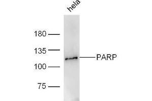 Human HeLa lysates probed with Rabbit Anti-PARP1 Polyclonal Antibody, Unconjugated  at 1:5000 for 90 min at 37˚C. (PARP1 antibody  (AA 201-300))