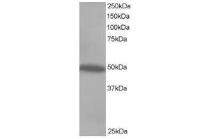 Image no. 1 for anti-C-Src tyrosine Kinase (CSK) (C-Term) antibody (ABIN374096) (CSK antibody  (C-Term))