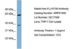 WB Suggested Anti-FLJ10769  Antibody Titration: 0. (FLJ10769 (Middle Region) antibody)