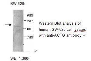 Image no. 1 for anti-Actin, gamma 1 (ACTG1) antibody (ABIN790765) (Actin, gamma 1 antibody)