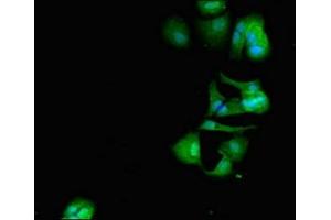 Immunofluorescent analysis of MCF-7 cells using ABIN7150470 at dilution of 1:100 and Alexa Fluor 488-congugated AffiniPure Goat Anti-Rabbit IgG(H+L) (CRCP antibody  (AA 1-115))