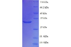 SDS-PAGE (SDS) image for TAF12 RNA Polymerase II, TATA Box Binding Protein (TBP)-Associated Factor, 20kDa (TAF12) (AA 1-161), (full length) protein (His-SUMO Tag) (ABIN5711345) (TAF12 Protein (AA 1-161, full length) (His-SUMO Tag))