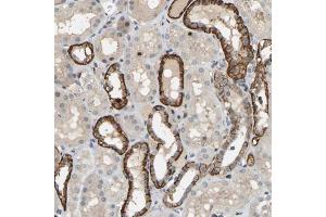 Immunohistochemical staining (Formalin-fixed paraffin-embedded sections) of human kidney shows strong cytoplasmic and membranous positivity in renal tubules. (PTPN4 antibody  (AA 743-831))