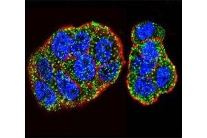 Confocal immunofluorescent analysis of KRAS antibody with WiDr cells followed by Alexa Fluor 488-conjugated goat anti-rabbit lgG (green). (K-RAS antibody  (AA 146-174))
