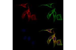 ABIN6262436 and ABIN6279508 staining 3 by IF/ICC.