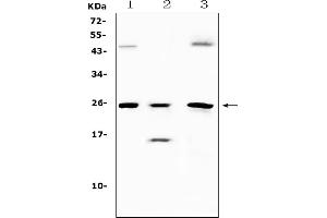 Western blot analysis of TIMP4 using anti-TIMP4 antibody (ABIN5518879).