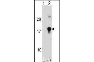 Western blot analysis of HMGN3 (arrow) using rabbit polyclonal HMGN3 Antibody (N-term) (ABIN1538803 and ABIN2848496).