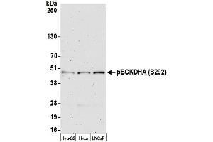 anti-Branched Chain Keto Acid Dehydrogenase E1, alpha Polypeptide (BCKDHA) (pSer292) antibody