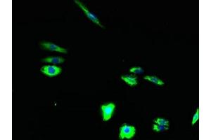 Immunofluorescent analysis of HepG2 cells using ABIN7171854 at dilution of 1:100 and Alexa Fluor 488-congugated AffiniPure Goat Anti-Rabbit IgG(H+L) (Tetraspanin 15 antibody  (AA 115-235))