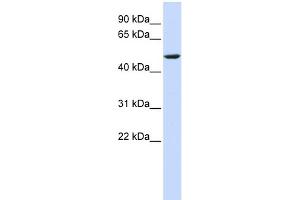 WB Suggested Anti-CYB561 Antibody Titration:  0. (CYB561 antibody  (Middle Region))
