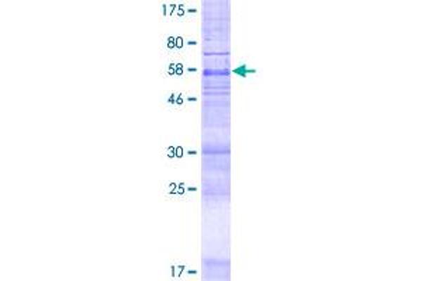 MBOAT1 Protein (AA 1-371) (GST tag)