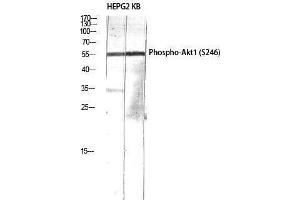 Western Blotting (WB) image for anti-V-Akt Murine Thymoma Viral Oncogene Homolog 1 (AKT1) (pSer246) antibody (ABIN3181906) (AKT1 antibody  (pSer246))