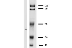 Western blotting analysis of HLA-G in LCL-HLA-G transfectants using anti-HLA-G (MEM-G/2). (HLAG antibody)
