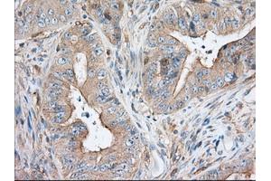 Immunohistochemical staining of paraffin-embedded Human pancreas tissue using anti-SNX9 mouse monoclonal antibody. (SNX9 antibody)