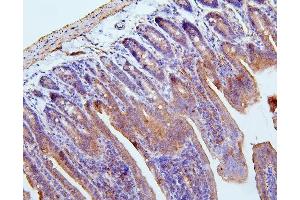 IHC analysis of Filamin B/FLNB using anti-Filamin B/FLNB antibody (ABIN7601607). (FLNB antibody  (AA 397-701))