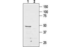 Angiotensin II Type 2 Receptor antibody  (Extracellular, N-Term)