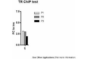 Image no. 3 for anti-Thyroid Hormone Receptor, beta (THRB) (N-Term) antibody (ABIN501627)