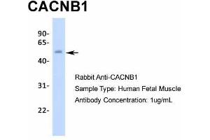 Western Blotting (WB) image for anti-Calcium Channel, Voltage-Dependent, beta 1 Subunit (CACNB1) (N-Term) antibody (ABIN2776092)