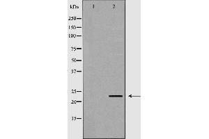 Western blot analysis of extracts of mouse livertissue lysate, using NEUROG3 antibody. (Neurogenin 3 antibody  (N-Term))