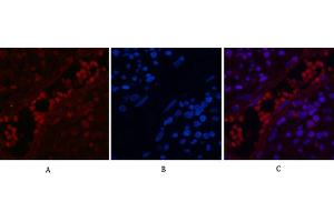 Immunofluorescence analysis of human appendix tissue. (NF-kB p65 antibody  (acLys310))