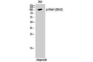 Western Blotting (WB) image for anti-WEE1 Homolog (S. Pombe) (WEE1) (pSer642) antibody (ABIN3182286) (WEE1 antibody  (pSer642))