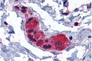 ABIN185041 (3. (MYRIP antibody  (C-Term))