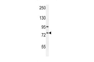 Western blot analysis in A549 cell line lysates (35ug/lane). (ALOX12B antibody  (C-Term))