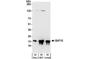 anti-Chromosome 17 Open Reading Frame 49 (C17orf49) (AA 122-172) antibody