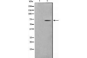 Western blot analysis on NIH-3T3 cell lysate using TGFR2 Antibody,The lane on the left is treated with the antigen-specific peptide. (TGFBR2 antibody  (Internal Region))