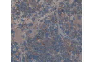 Used in DAB staining on fromalin fixed paraffin- embedded spleen tissue (DTNBP1 antibody  (AA 110-305))