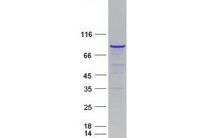 Western Blotting (WB) image for Membrane Protein, Palmitoylated 5 (MAGUK P55 Subfamily Member 5) (MPP5) protein (Myc-DYKDDDDK Tag) (ABIN2726298)